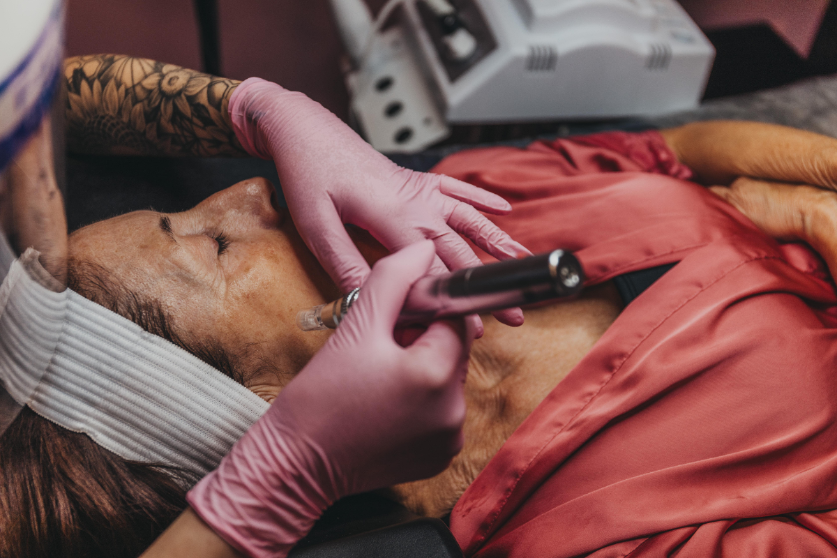 Highland Laser Clinic: Tattoo Removal Experts in the North of Scotland